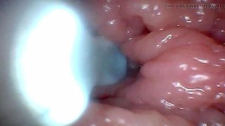 Teen POV: Endoscope G-Spot Close-Up – First Time Deep Pussy Exam