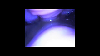 Speculum & Microcamera for Lady Soniac